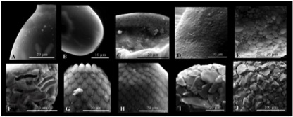 Structural variability of the shell of testate amoebae (Source; Maxence Delaine)