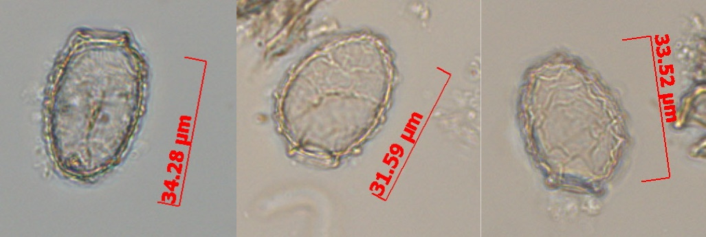 Three examples of an a yet to be confirmed test from Ardley Island, Antarctic Peninsula.