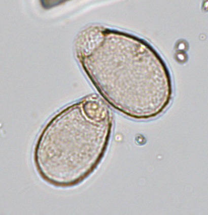 The ubiquitous Corythion dubium, found in abundance in most Antarctic Peninsula sites.