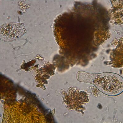 Tropical testate amoebae as hydrological indicators?
