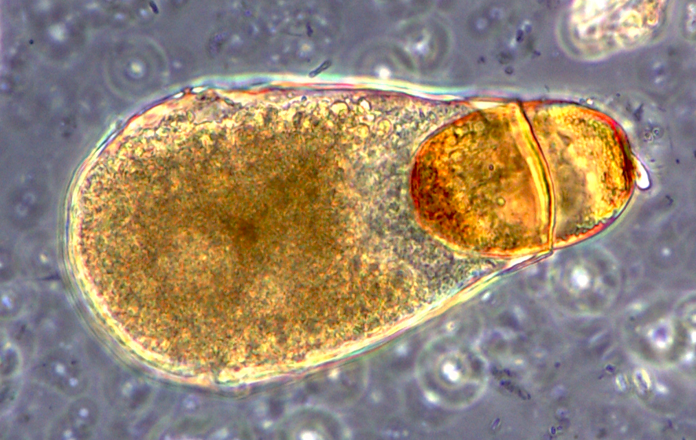 Hyalosphenia papilio taking its revenge on Archerella flavum H. papilio feeding on A. flavum.