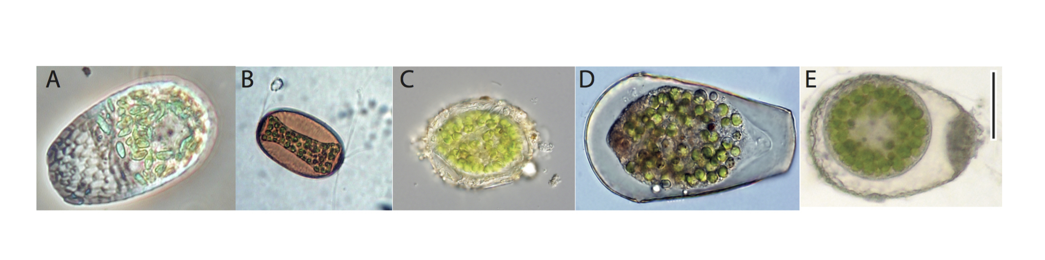 Some mixotrophic testate amoebae we can find in mosses : Placocista spinosa (A), Archerella flavum (B), Amphitrema wrigthianum (C), Hyalosphenia papilio (D) and Heleopera sphagni (E). Scale bar on E = 50 μm