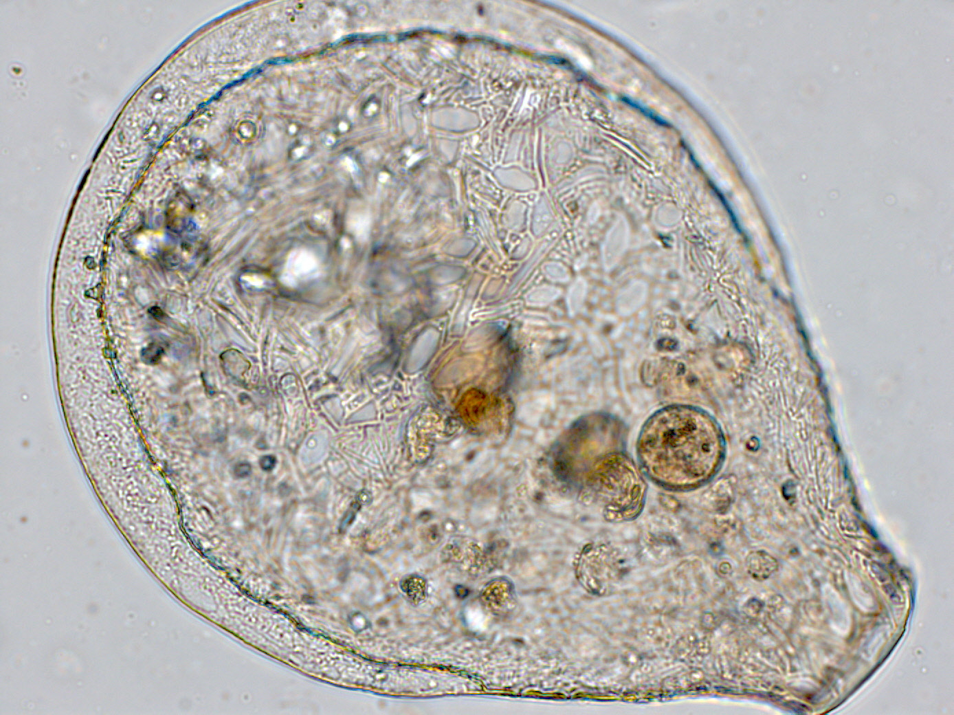 testate-4_nebela-carinata